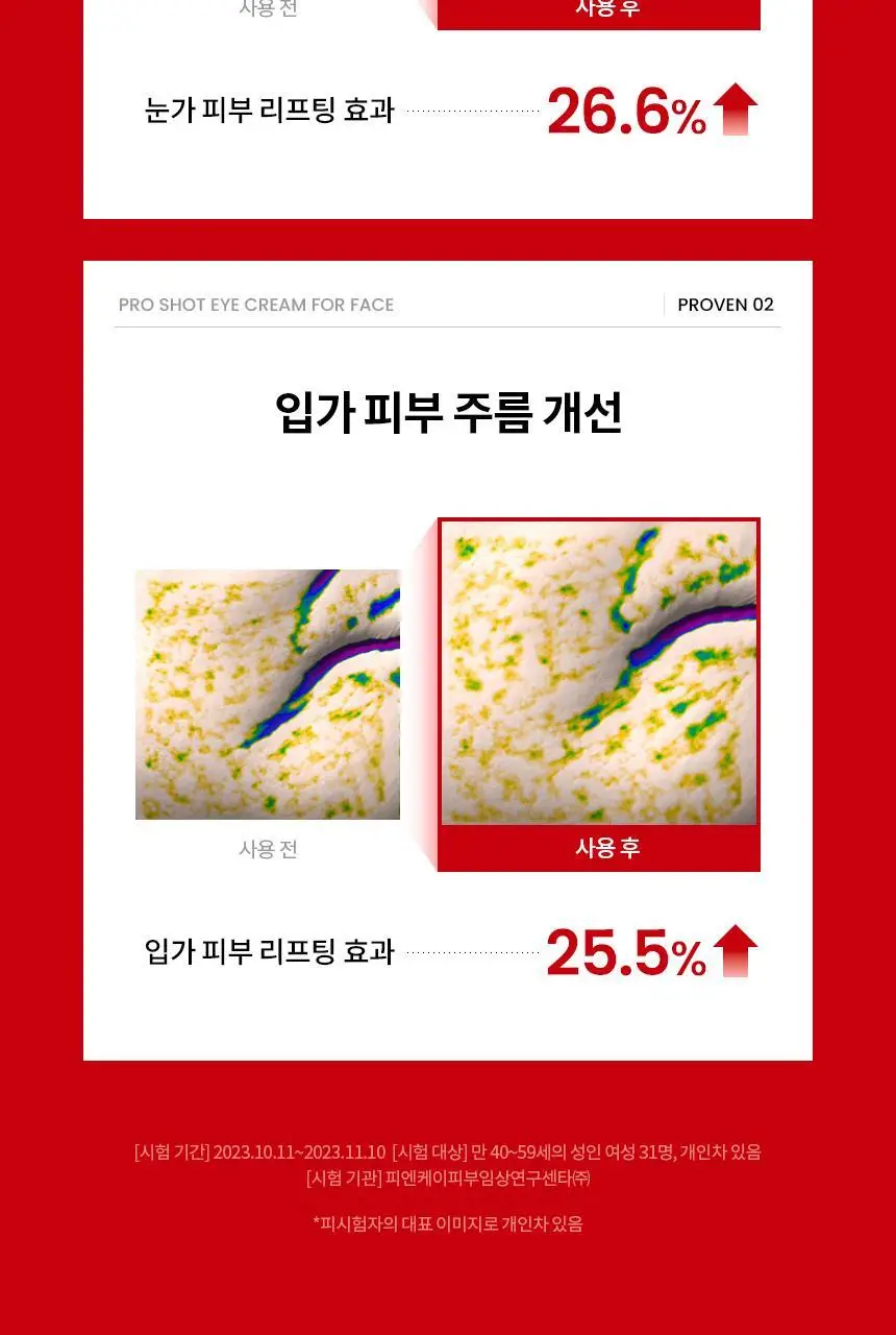 [단독기획] AHC 프로 샷 콜라 쥬비네이션 아이크림 포페이스 30ml 기획 (+세럼10ml) 상세페이지 17